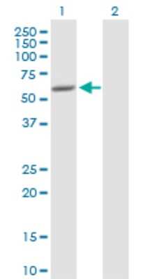 Western Blot: SCIN Antibody [H00085477-D01P]