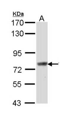 Western Blot: SCIN Antibody [NBP1-31721]