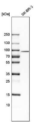 Western Blot: SCIN Antibody [NBP1-89230]