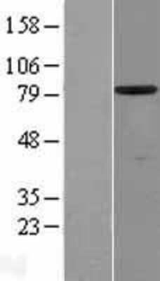 Western Blot: SCIN Overexpression Lysate [NBP2-04409]