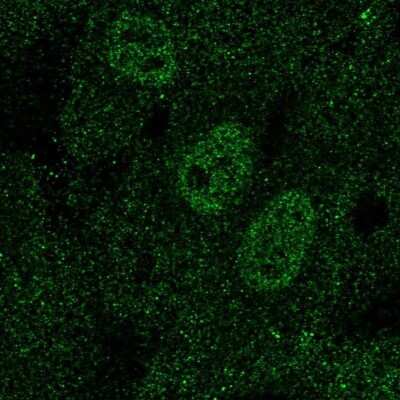 Immunocytochemistry/ Immunofluorescence: SCL/Tal1 Antibody [NBP2-68973]