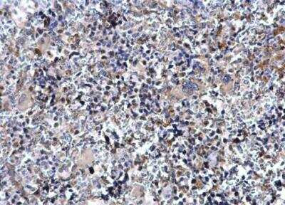 Immunohistochemistry-Paraffin: SCL/Tal1 Antibody [NBP1-33757]