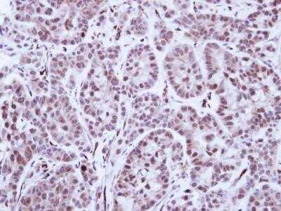 Immunohistochemistry-Paraffin: SCL/Tal1 Antibody [NBP1-33757]