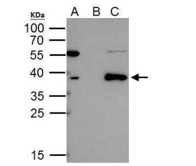 Immunoprecipitation: SCL/Tal1 Antibody [NBP1-33757]