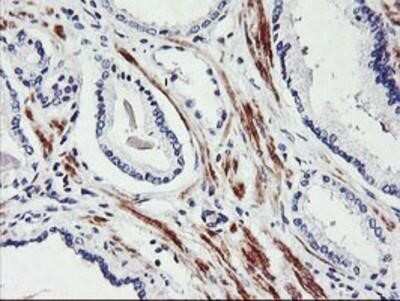 Immunohistochemistry: SCL/Tal1 Antibody (OTI5H1) - Azide and BSA Free [NBP2-74022]