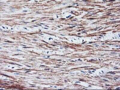 Immunohistochemistry: SCL/Tal1 Antibody (OTI5H1) - Azide and BSA Free [NBP2-74022]