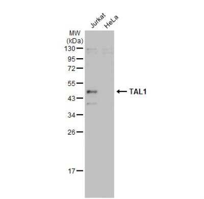 Western Blot: SCL/Tal1 Antibody [NBP1-33757]