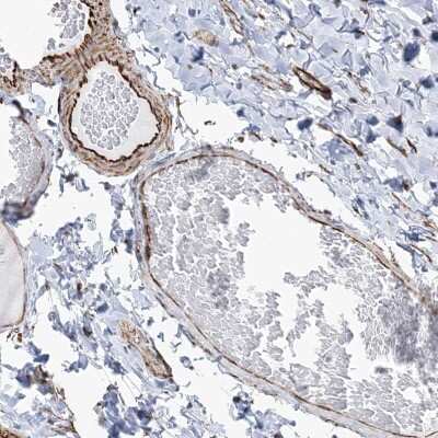 Immunohistochemistry: SCLT1 Antibody [NBP2-48659]