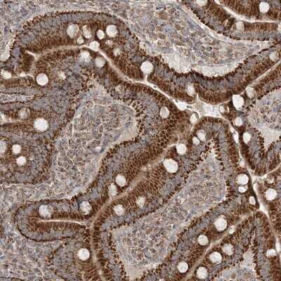 Immunohistochemistry-Paraffin: SCLT1 Antibody [NBP1-93891]