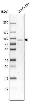 Western Blot: SCLT1 Antibody [NBP1-93891]