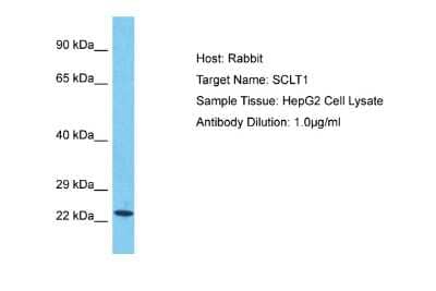 Western Blot: SCLT1 Antibody [NBP2-85696]