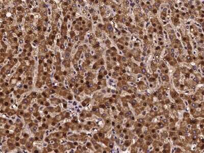 Immunohistochemistry-Paraffin: SCLY Antibody [NBP2-97263]