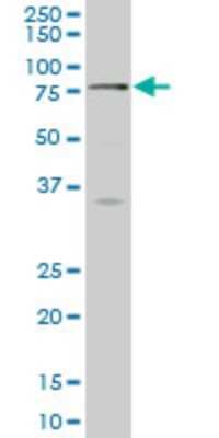 Western Blot: SCMH1 Antibody (1H2) [H00022955-M02]