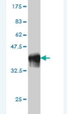 Western Blot: SCMH1 Antibody (2D7) [H00022955-M01]