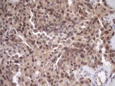 Immunohistochemistry: SCMH1 Antibody (OTI5E6) [NBP2-45724]