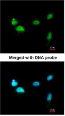 Immunocytochemistry/ Immunofluorescence: SCMH1 Antibody [NBP1-32517]