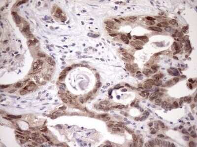 Immunohistochemistry: SCMH1 Antibody (OTI5E6) - Azide and BSA Free [NBP2-74023]