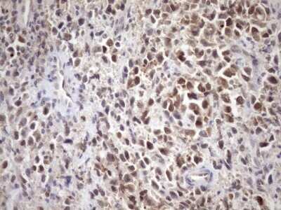 Immunohistochemistry: SCMH1 Antibody (OTI5E6) - Azide and BSA Free [NBP2-74023]