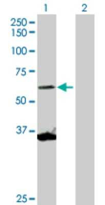 Western Blot: SCMH1 Antibody [H00022955-D01P]