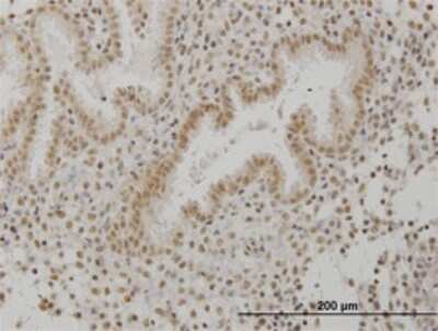Immunohistochemistry-Paraffin: SCML1 Antibody (4G3) [H00006322-M01]