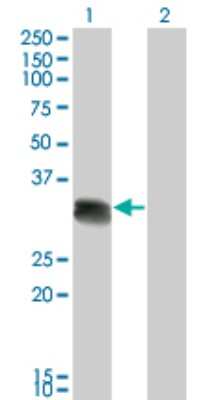 Western Blot: SCML1 Antibody (4G3) [H00006322-M01]