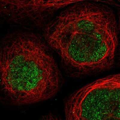 Immunocytochemistry/ Immunofluorescence: SCML1 Antibody [NBP1-86309]