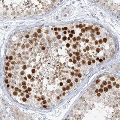 Immunohistochemistry-Paraffin: SCML1 Antibody [NBP1-85909]