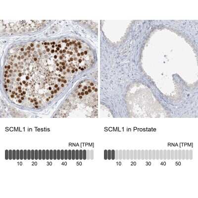 Immunohistochemistry-Paraffin: SCML1 Antibody [NBP1-85909]