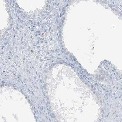 Immunohistochemistry-Paraffin: SCML1 Antibody [NBP1-86309]