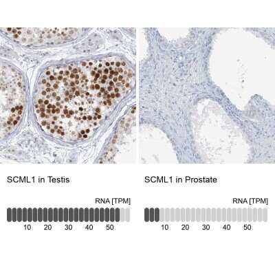 Immunohistochemistry-Paraffin: SCML1 Antibody [NBP1-86309]
