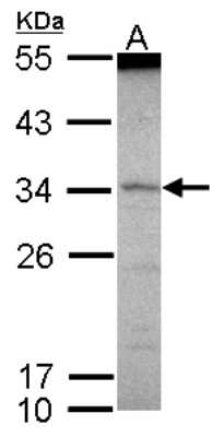 Western Blot: SCML1 Antibody [NBP2-20270]