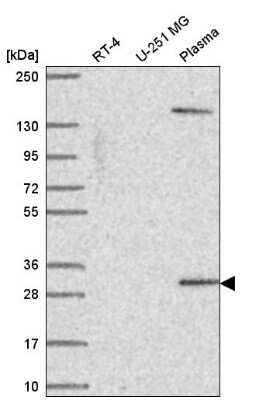 Western Blot: SCML1 Antibody [NBP2-55711]