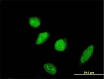 Immunocytochemistry/ Immunofluorescence: SCML2 Antibody (1C8) [H00010389-M01]