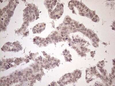 Immunohistochemistry: SCML2 Antibody (OTI1E1) [NBP2-45725]