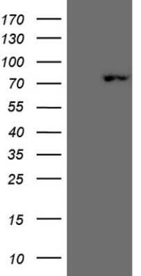 Western Blot: SCML2 Antibody (OTI1E1) [NBP2-45725]