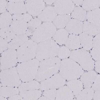 Immunohistochemistry-Paraffin: SCML2 Antibody [NBP2-56280]