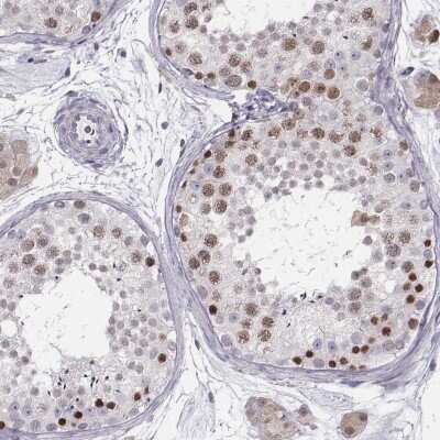 Immunohistochemistry-Paraffin: SCML2 Antibody [NBP2-56280]