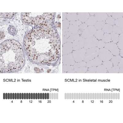 Immunohistochemistry-Paraffin: SCML2 Antibody [NBP2-56280]