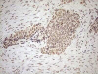 Immunohistochemistry: SCML2 Antibody (OTI1E1) - Azide and BSA Free [NBP2-74024]