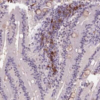 Immunohistochemistry-Paraffin: SCML4 Antibody [NBP2-57381]