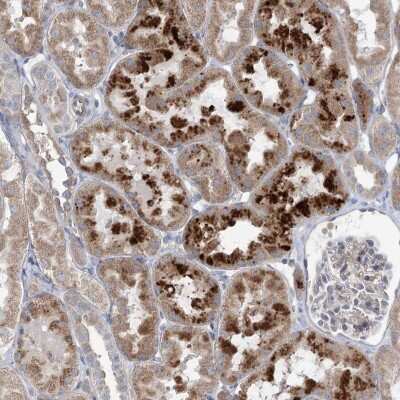 Immunohistochemistry: SCN11A Antibody [NBP2-48665]