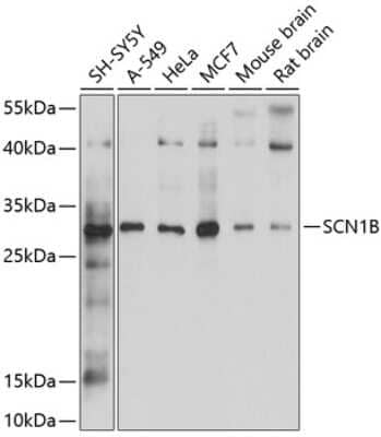 Western Blot: SCN1B AntibodyBSA Free [NBP2-94559]