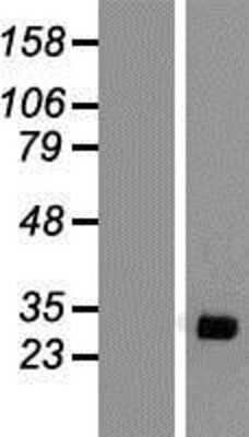 Western Blot: SCN1B Overexpression Lysate [NBP2-04663]