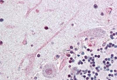 Immunohistochemistry-Paraffin: SCN3A Antibody [NBP3-14469]