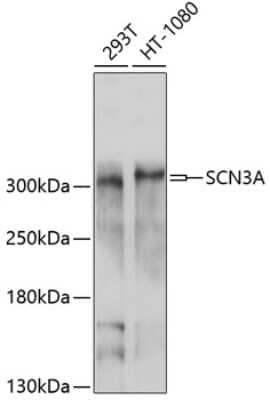 Western Blot: SCN3A AntibodyBSA Free [NBP2-94560]