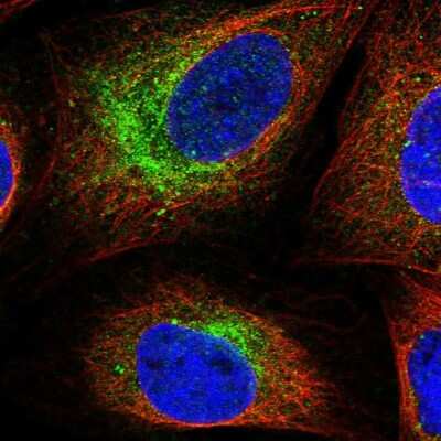 Immunocytochemistry/ Immunofluorescence: SCN3B Antibody [NBP2-68642]