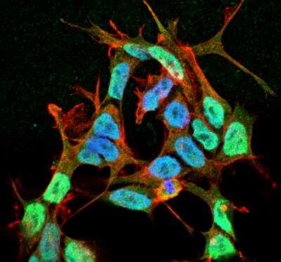 Immunocytochemistry/ Immunofluorescence: SCN3B Antibody (S396-29) [NBP2-59318]