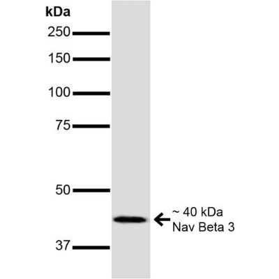 Western Blot: SCN3B Antibody (S396-29) [NBP2-59318]