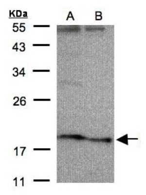 Western Blot: SCN3B Antibody [NBP1-32336]