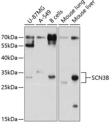 Western Blot: SCN3B AntibodyBSA Free [NBP2-93427]